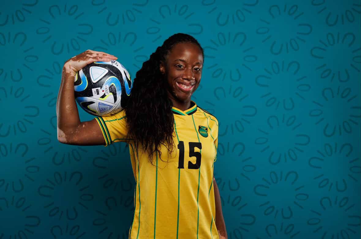 Reggae Girl and vitiligo advocate Tiffany Cameron says Winnie Harlow’s childhood story can change lives and has the power to help those who struggle with their self-image.