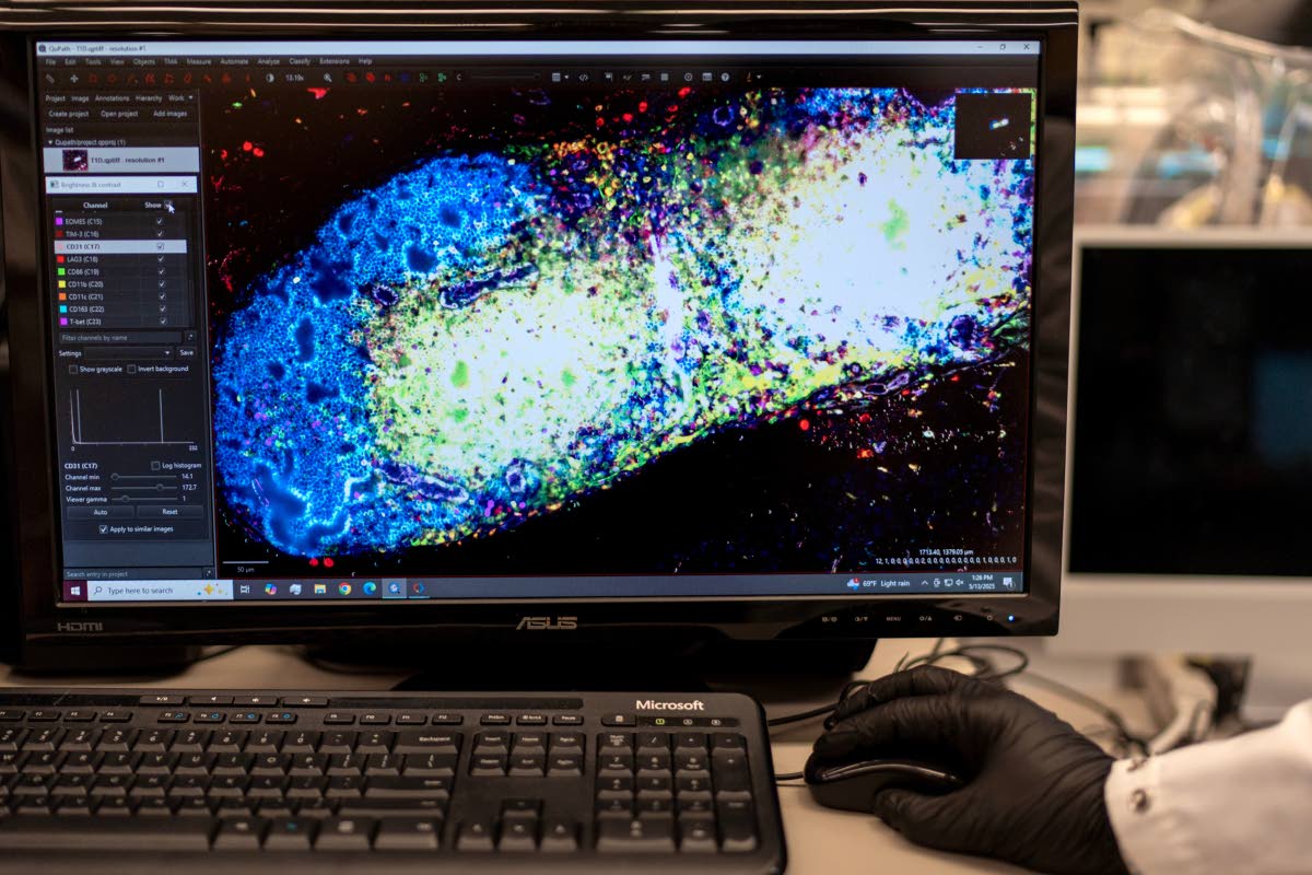 Research fellow Sachin Surwase shows an image of a pancreatic lymph node from a mouse in the lab where he studies autoimmune diseases at Johns Hopkins University in Baltimore, Maryland.