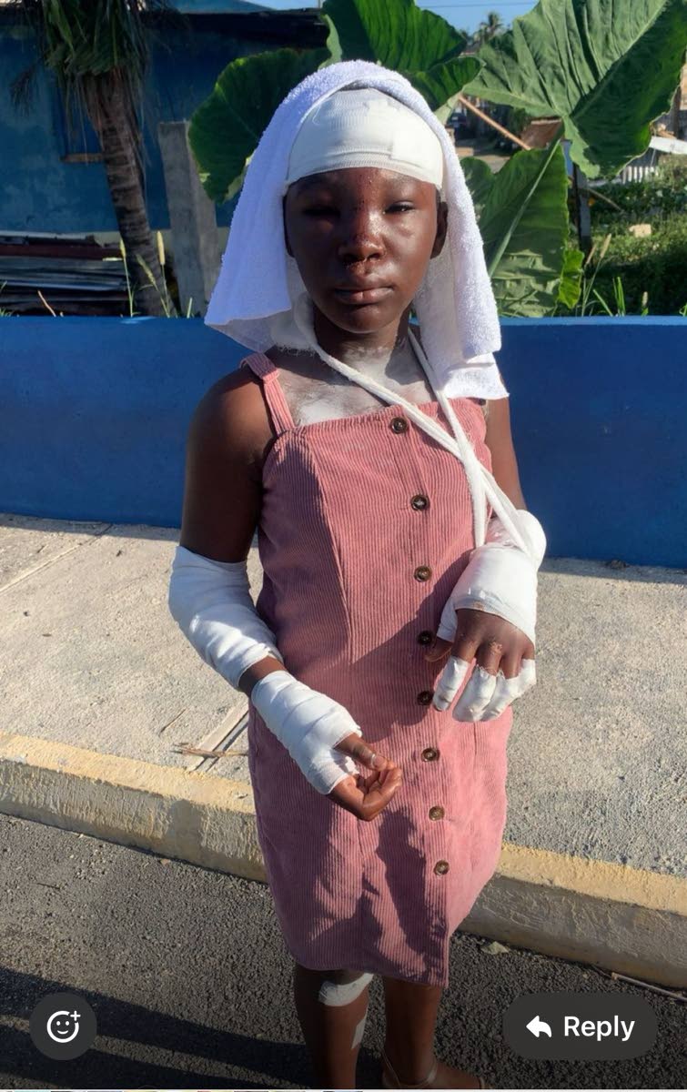 Shaville Moodie, recovering at home and missing school.