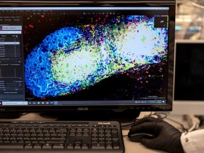 Research fellow Sachin Surwase shows an image of a pancreatic lymph node from a mouse in the lab where he studies autoimmune diseases at Johns Hopkins University in Baltimore, Maryland.