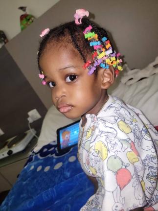 Azora Elson, one of the Jamaican conjoined twins who were successfully separated in Saudia Arabia in 2025, has died. (Contributed photo)